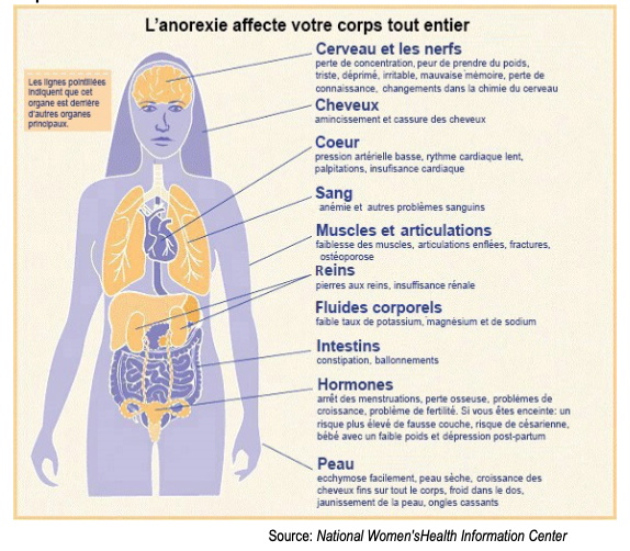 L’anorexie : Un trouble du comportement alimentaire TCA